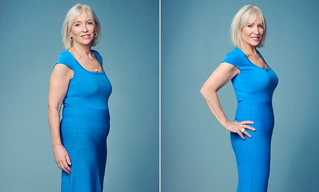 Nadine Dorries before she made the decision to jump on the Ozempic bandwagon - her excess weight was mostly around the middle